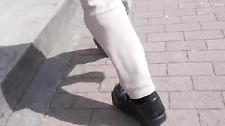 866-youth-with-areare-dss