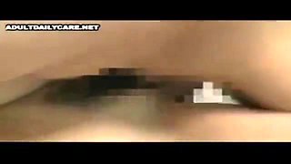 083-youth-with-areare-abs