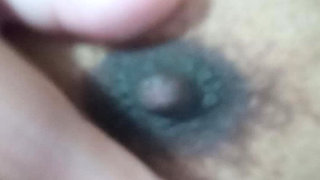 Nipples