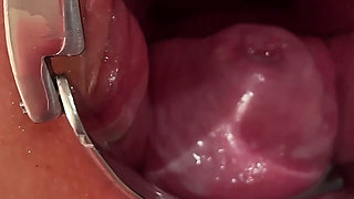 Masked Schoolgirl Extreme Cervix View and Double Vaginal Fisting